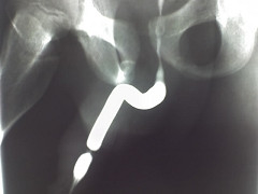 thumb image