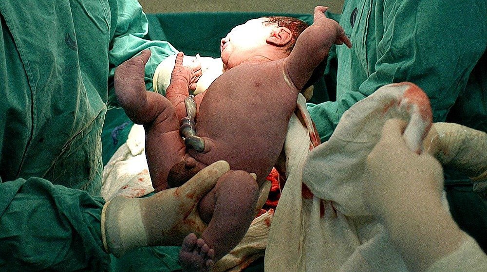 thumb image