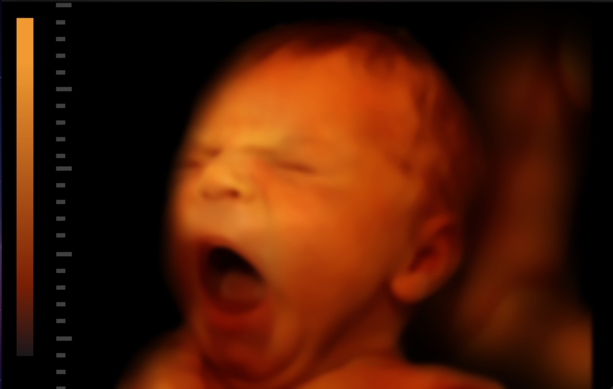 image title thumb image