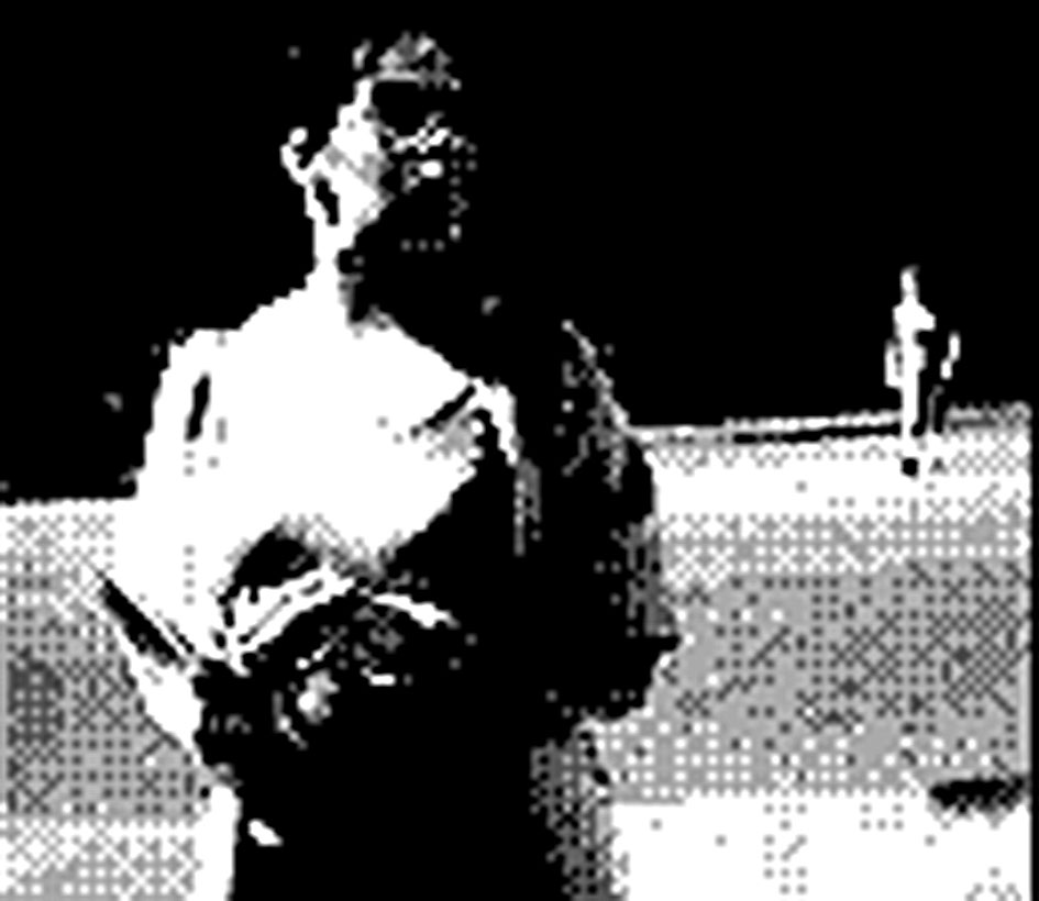 thumb image