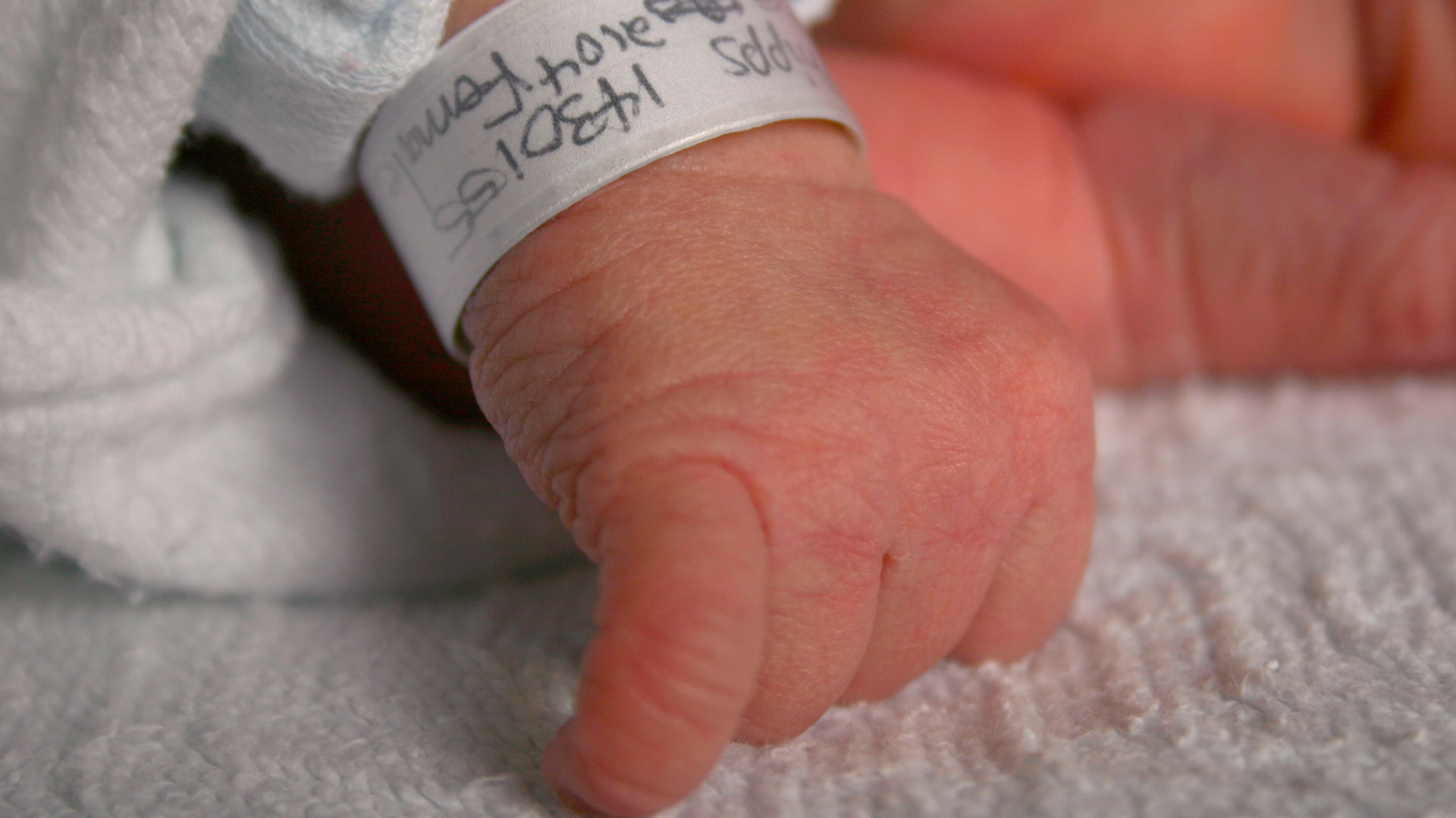thumb image